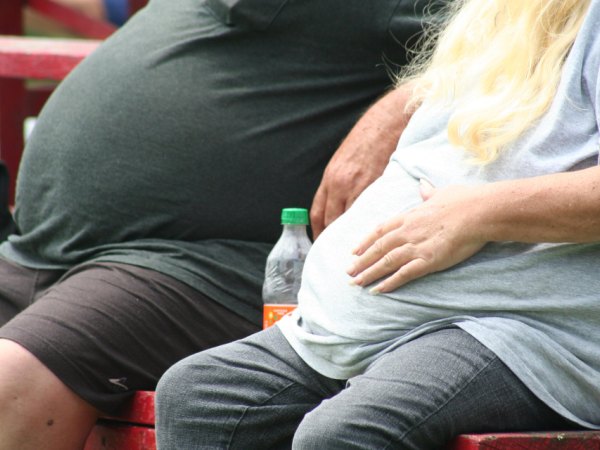 tratamiento de la obesidad