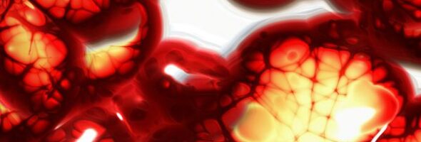 Anemia ¿Tienes una deficiencia de hierro?